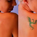 remove temporary tattoo